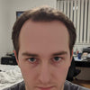 Profile 2