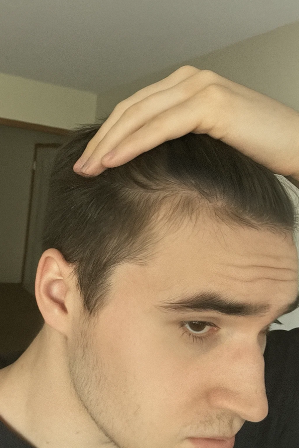 Before transformation 1